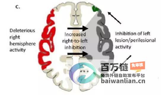 大脑受损和治疗方案探索 失语症 (大脑受损和治疗有关吗)